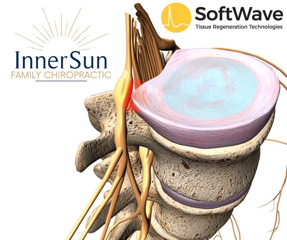 Understanding SoftWave Therapy's Role in Disc Herniation Relief